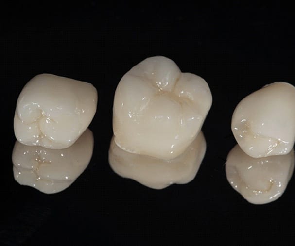porcelain dental crowns sitting next to each other
