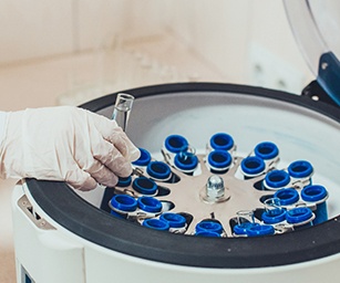 a dentist pulling a tube out of a centrifuge 