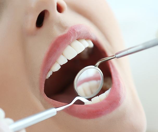 Closeup of smile during dental exam