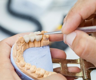 dentist creating dental bridge 
