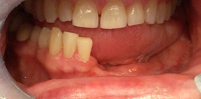 Yellow smile before teeth whitening