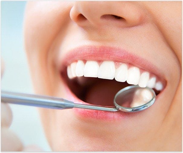 Closeup of smile during dental exam