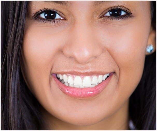 Woman with healthy smile