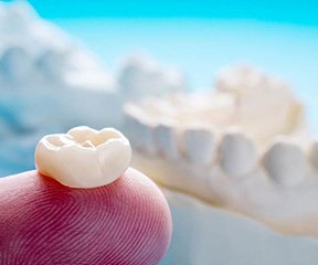 A closeup of a dental crown laying on someone’s finger