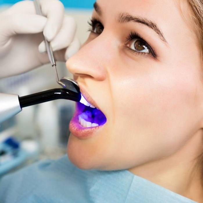 girl getting tooth-colored filling in Sparta hardened with curing light