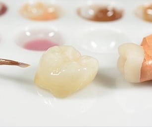 close-up of a ceramic dental crown