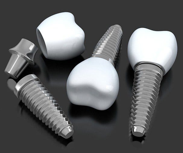 A digital image of multiple dental implants in Sparta lying on a table