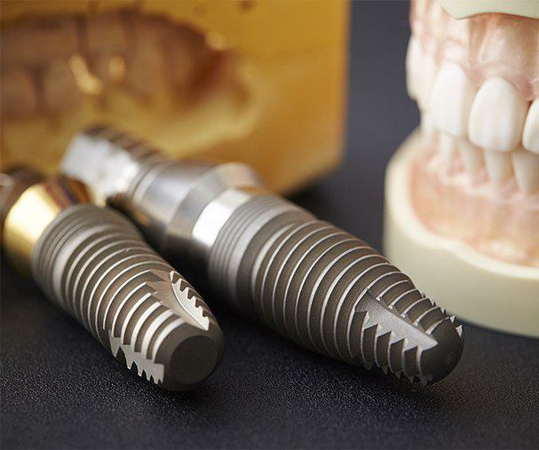 dental implant posts lying next to a set of false teeth 