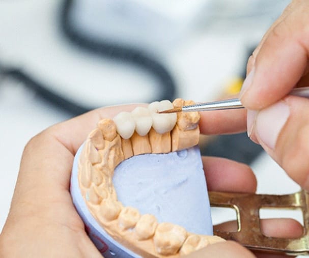 dentist polishing customized crowns