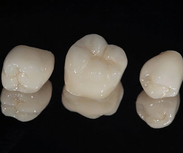 three dental crowns placed next to each other