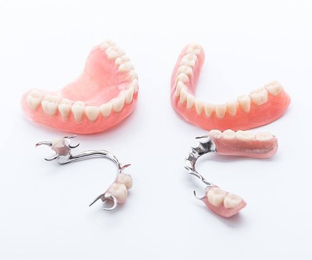 Four types of dentures