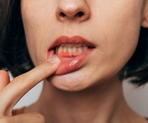 Lady shows inflamed gums