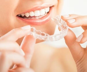 Woman placing Invisalign tray