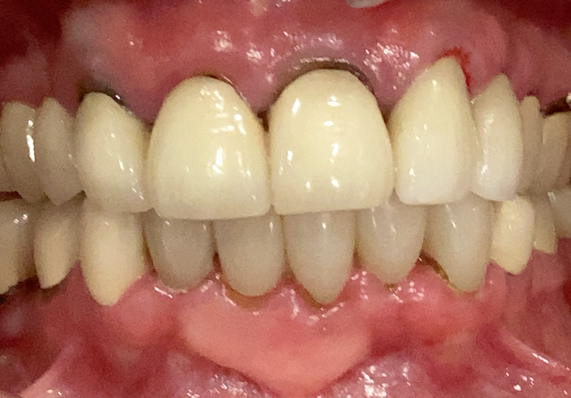 Yellow smile before teeth whitening