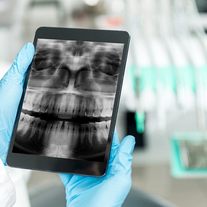 Dental x-rays on tablet computer