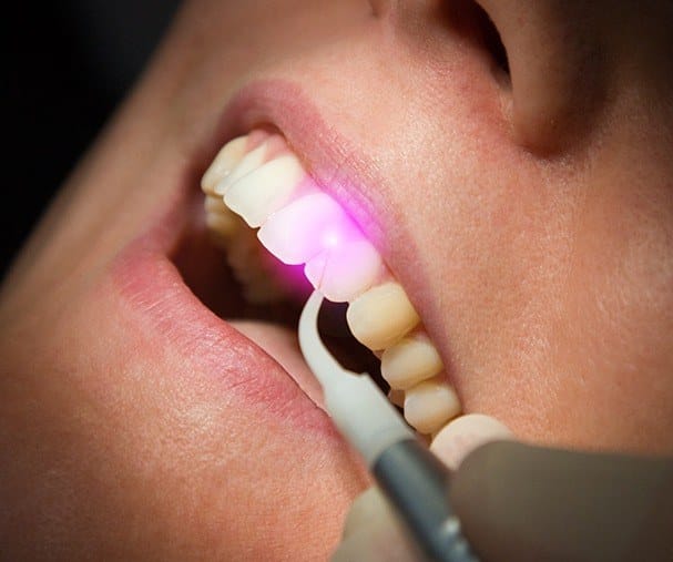 Patient receiving laser dentistry treatment