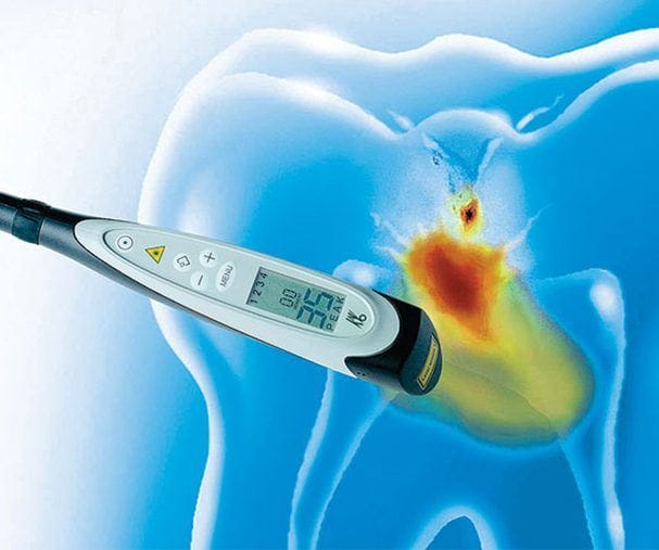 Laser cavity detection system