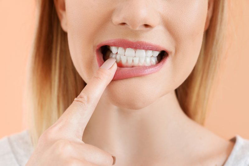 a young woman pulling down her bottom lip and pointing to her red gums