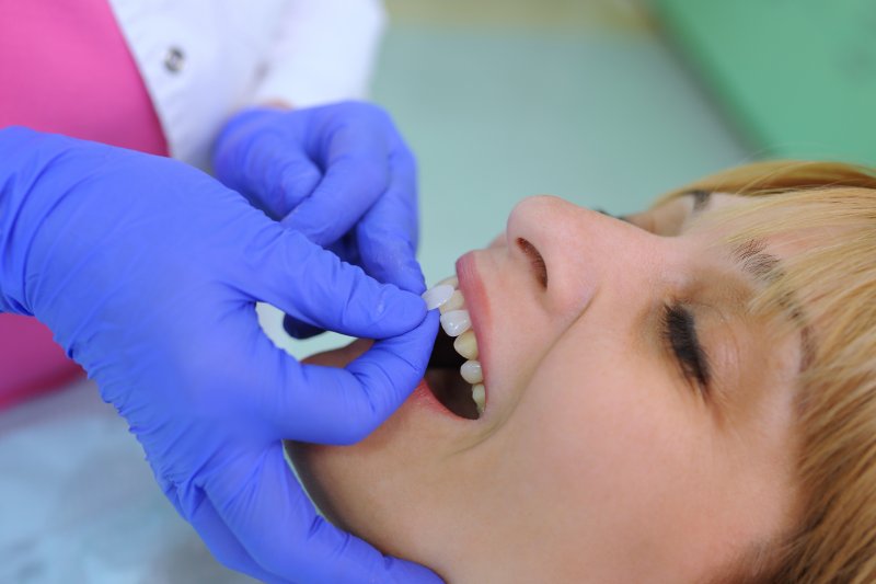 woman getting veneers put on at cosmetic dentist in Sparta