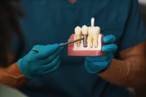 Dentist holding dental implants.